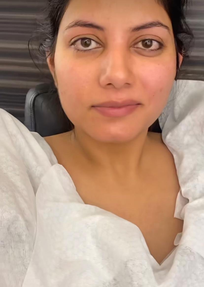 GLAM MAM before and after